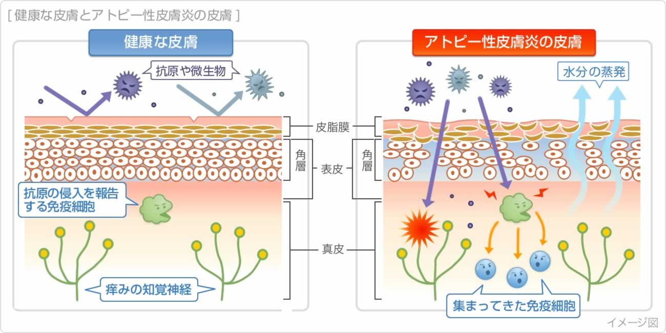 当院で扱う皮膚疾患 肌トラブルについて 女医の巣鴨千石皮ふ科