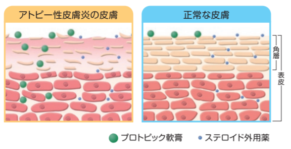 プロトピック軟膏の分子量