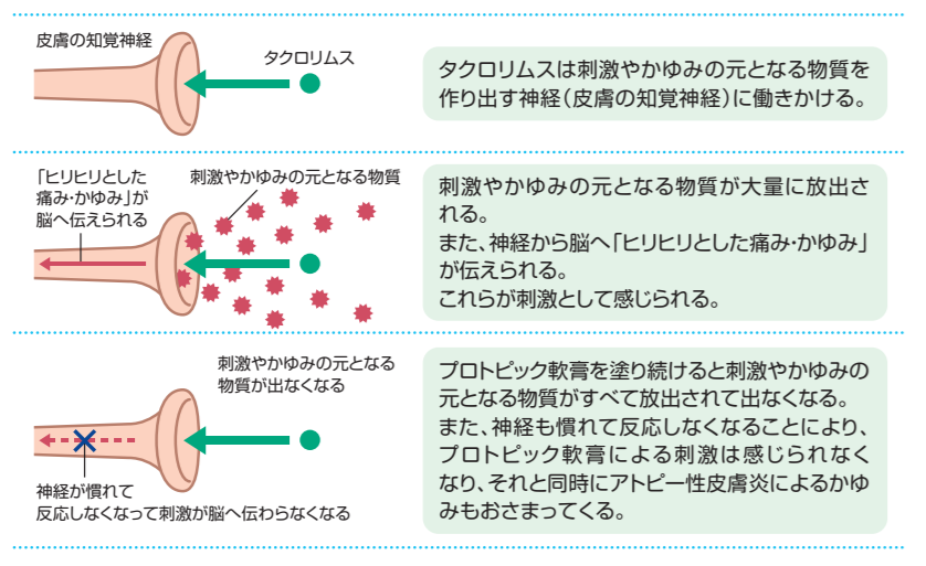 プロトピック軟膏で刺激を感じる理由