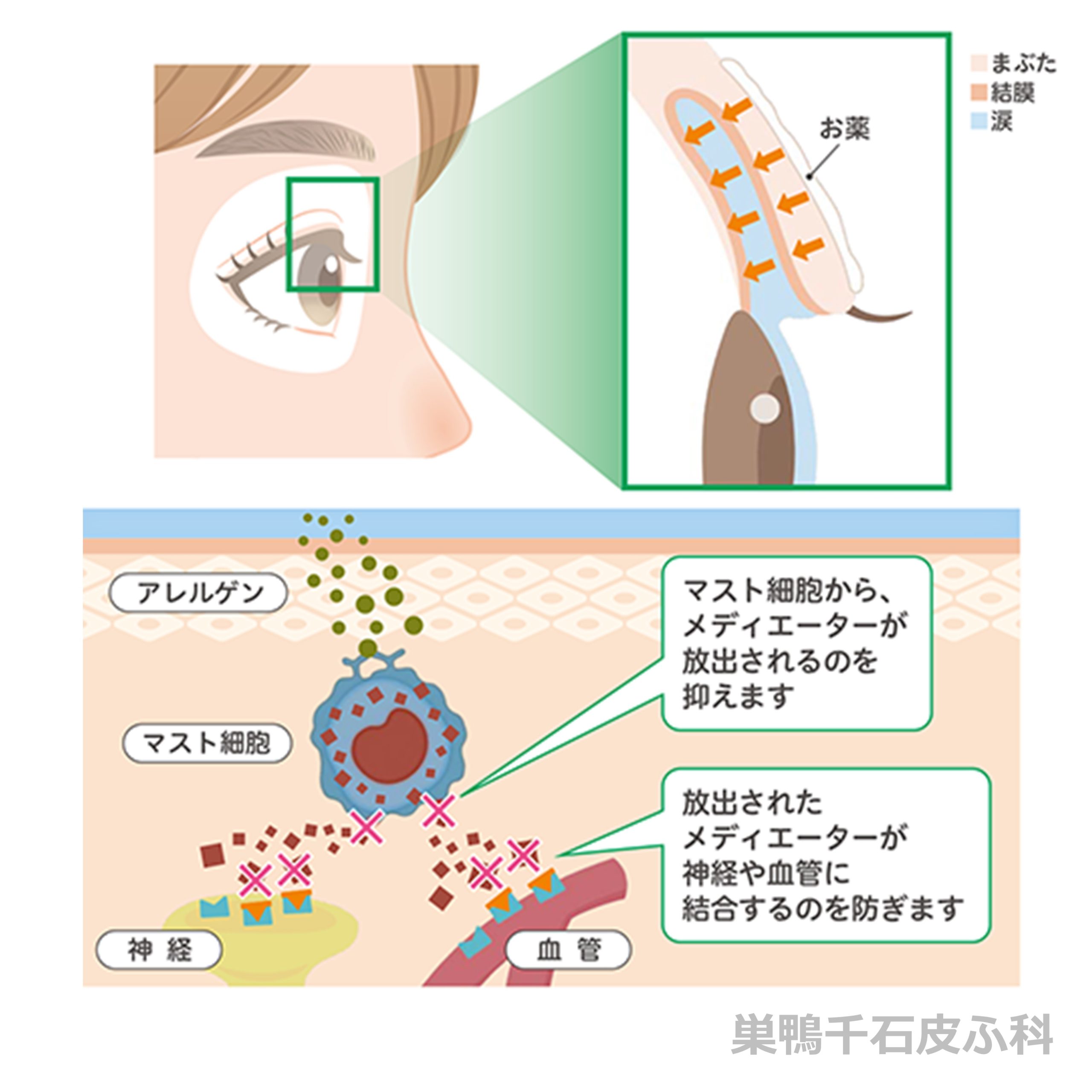 アレジオン眼瞼クリームの作用機序