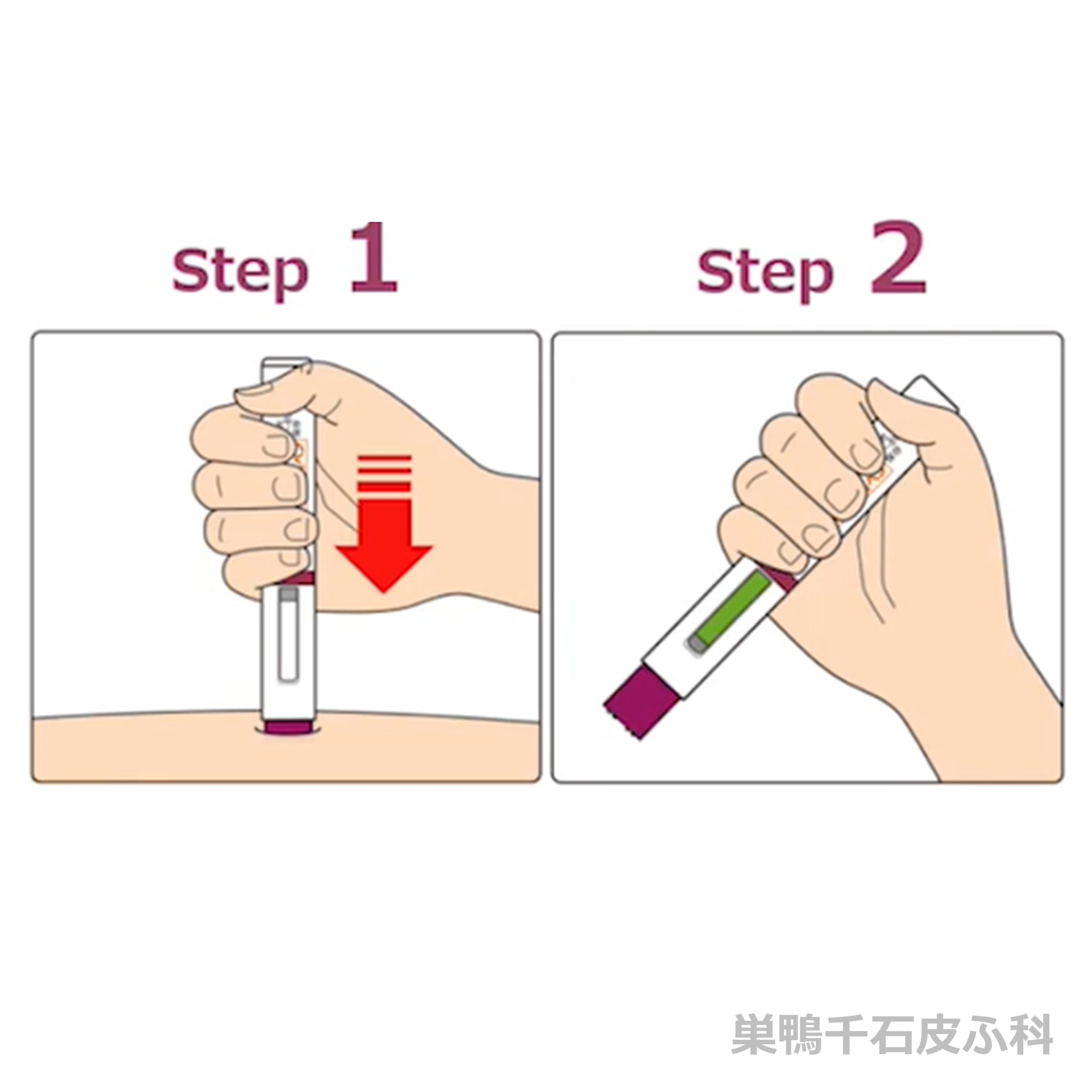 ゾレア投与方法