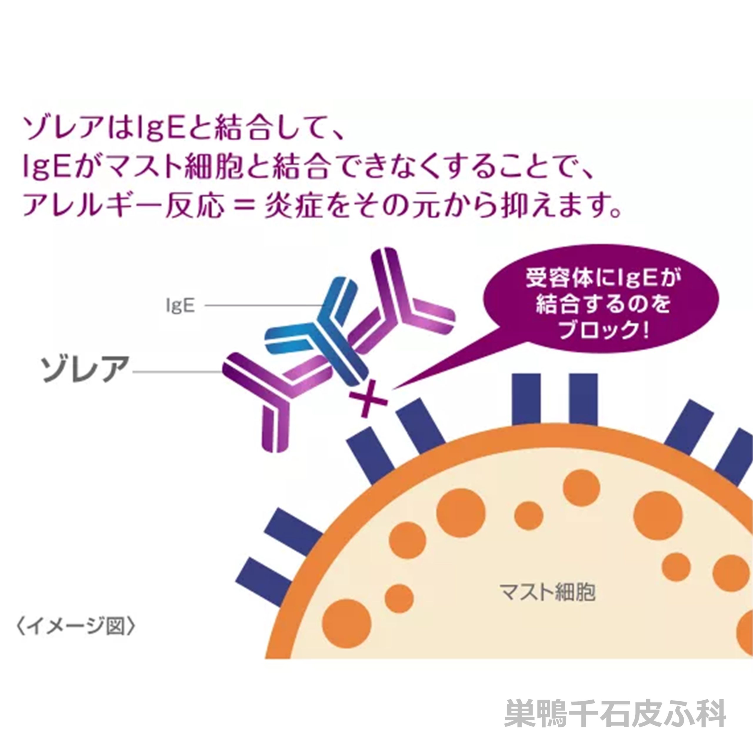 ゾレアの作用機序