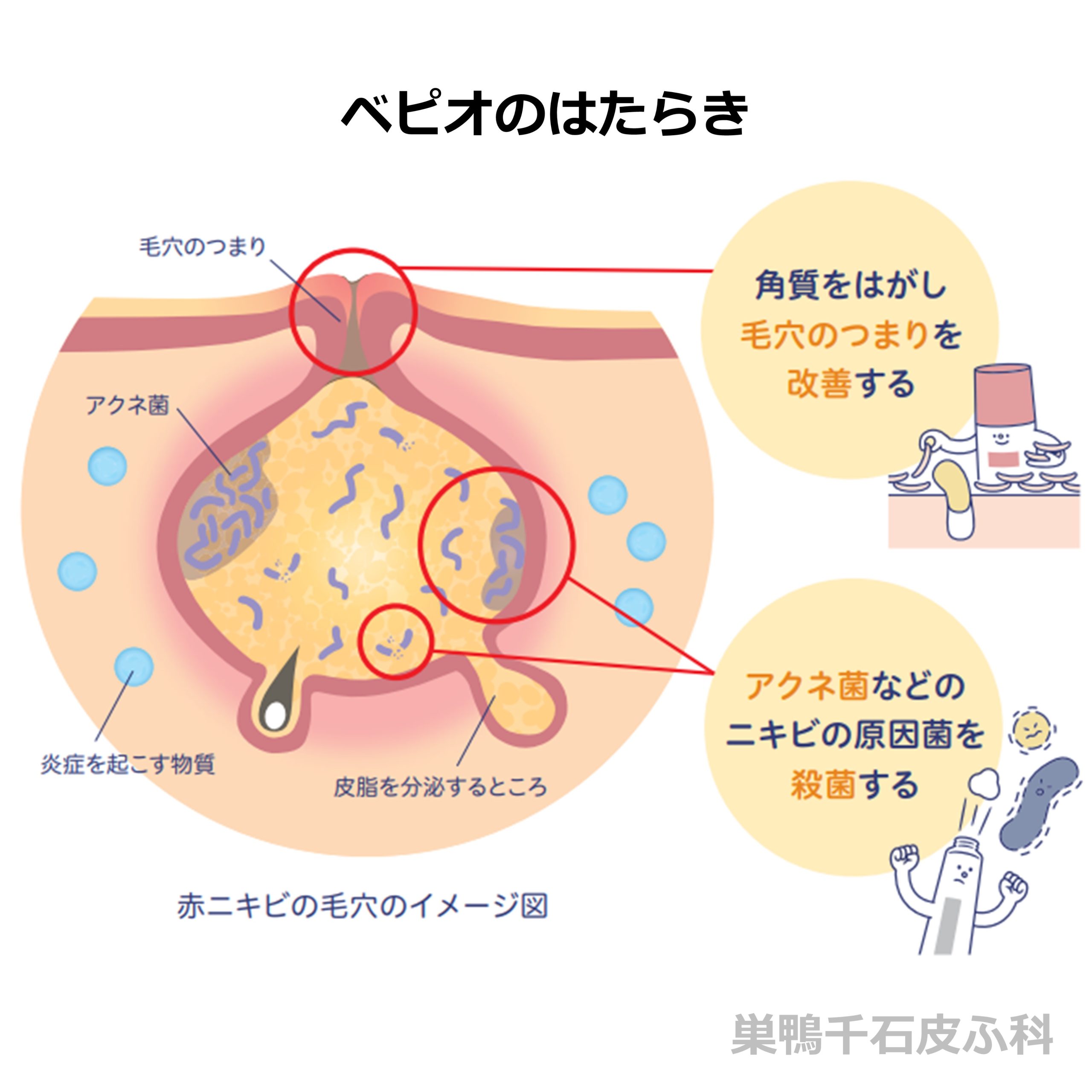ベピオのはたらき